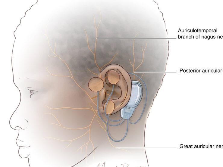 Illustration by Mandy Root-Thompson